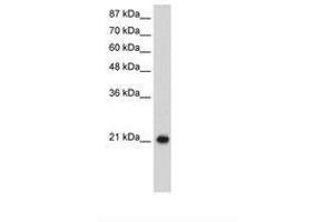 Image no. 1 for anti-Ribosomal Protein L9 (RPL9) (C-Term) antibody (ABIN203025)