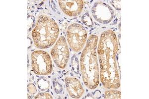 Immunohistochemistry of paraffin embedded human kidney using Clcn5 (ABIN7073471) at dilution of 1:200 (400x lens) (Chloride Channel 5 抗体)