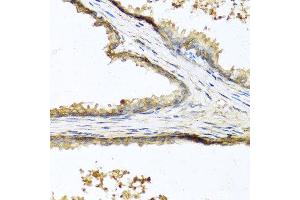 Immunohistochemistry of paraffin-embedded human prostate using SOST antibody at dilution of 1:100 (40x lens). (Sclerostin 抗体)