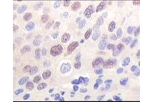 Immunohistochemistry (IHC) image for anti-K(lysine) Acetyltransferase 8 (KAT8) (truncated) antibody (ABIN2464086) (MYST1 抗体  (truncated))