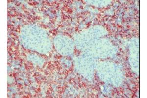 Image no. 1 for anti-Macrophages antibody (ABIN481657) (Macrophages 抗体)