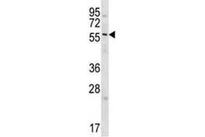 Western Blotting (WB) image for anti-Glypican 3 (GPC3) (AA 529-560) antibody (ABIN3031100)