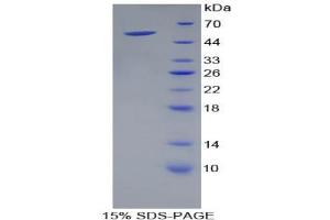 SDS-PAGE analysis of Mouse Kallikrein 4 Protein. (Kallikrein 4 蛋白)
