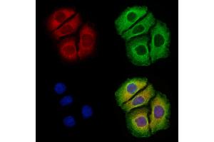 Arc Antibody staining Hela cells by IF/ICC. (Arc 抗体  (Internal Region))