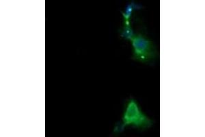 Image no. 5 for anti-Retinoic Acid Receptor Responder (Tazarotene Induced) 1 (RARRES1) antibody (ABIN1500600) (RARRES1 抗体)