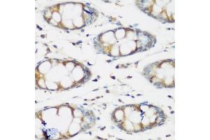 Immunohistochemistry of paraffin-embedded human colon using BMP2 antibody (ABIN5970060) at dilution of 1/200 (40x lens). (BMP2 抗体)