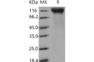 Western Blotting (WB) image for Interleukin 12 Receptor, beta 2 (IL12RB2) (Active) protein (His tag) (ABIN7320408) (IL12RB2 Protein (His tag))
