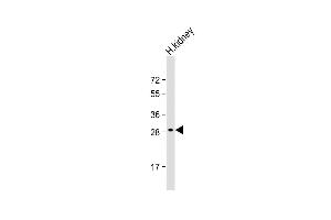 Anti-DIO1 Antibody (N-term) at 1:2000 dilution + human kidney whole cell lysate Lysates/proteins at 20 μg per lane. (DIO1 抗体  (N-Term))