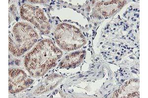 Immunohistochemical staining of paraffin-embedded Human Kidney tissue using anti-HOXC11 mouse monoclonal antibody. (HOXC11 抗体  (AA 1-304))