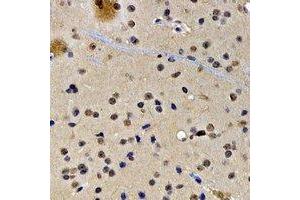Immunohistochemical analysis of SATB1 staining in rat brain formalin fixed paraffin embedded tissue section. (SATB1 抗体)