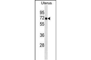 Western blot analysis in human Uterus tissue lysates (35ug/lane). (TRMT1 抗体  (N-Term))