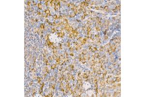 Immunohistochemistry of paraffin-embedded rat spleen using [KO Validated] RA Rabbit pAb (ABIN3021646, ABIN3021647, ABIN3021648 and ABIN1513457) at dilution of 1:100 (40x lens). (RAB5 抗体  (AA 1-215))