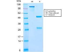 SDS-PAGE Analysis Purified BCL10 Recombinant Rabbit Monoclonal Antibody (BL10/2988R). (Recombinant BCL10 抗体  (AA 122-168))