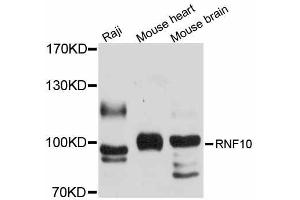 Western blot analysis of extracts of various cell lines, using RNF10 antibody (ABIN5998702) at 1/1000 dilution. (RNF10 抗体)