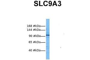 Western Blotting (WB) image for anti-Solute Carrier Family 9 (Sodium/hydrogen Exchanger), Member 3 (SLC9A3) (Middle Region) antibody (ABIN2773833)