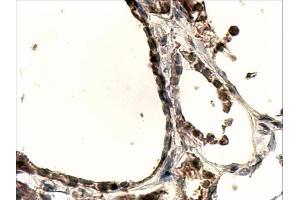ABIN263200 (4µg/ml) staining of paraffin embedded Human Thyroid Gland. (DUOX1 抗体  (Internal Region))