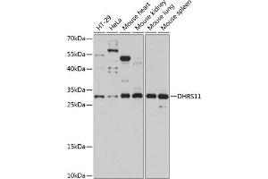 Western blot analysis of extracts of various cell lines, using DHRS11 antibody (ABIN7266723) at 1:1000 dilution. (DHRS11 抗体  (AA 1-260))