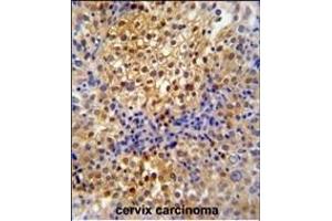 Immunohistochemistry (Paraffin-embedded Sections) (IHC (p)) image for anti-PRP38 Pre-mRNA Processing Factor 38 (Yeast) Domain Containing A (PRPF38A) (AA 283-312), (C-Term) antibody (ABIN653884)