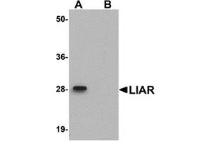 Western Blotting (WB) image for anti-Ankyrin Repeat Domain 54 (ANKRD54) (C-Term) antibody (ABIN1030482) (ANKRD54 抗体  (C-Term))