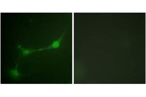 Immunofluorescence analysis of NIH-3T3 cells, using Ataxin 1 (Phospho-Ser776) Antibody. (Ataxin 1 抗体  (pSer776))