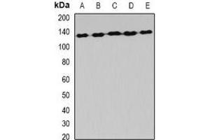 Western blot analysis of AlaRS expression in Hela (A), MCF7 (B), mouse liver (C), mouse brain (D), rat spinal cord (E) whole cell lysates. (AARS2 抗体)
