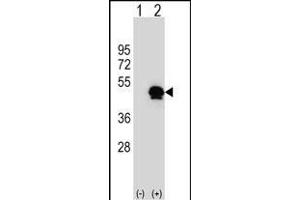 Western blot analysis of SERPINE1 (arrow) using rabbit polyclonal SERPINE1 Antibody (Center) (ABIN656843 and ABIN2846050). (PAI1 抗体  (AA 188-216))
