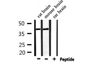 Western Blotting (WB) image for anti-Cyclin-Dependent Kinase 5, Regulatory Subunit 2 (p39) (CDK5R2) (Internal Region) antibody (ABIN6260714)