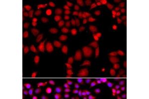 Immunofluorescence analysis of A549 cells using ARHGEF9 Polyclonal Antibody (Arhgef9 抗体)