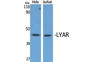 Western Blotting (WB) image for anti-Ly1 Antibody Reactive (LYAR) (Internal Region) antibody (ABIN3175884) (LYAR 抗体  (Internal Region))