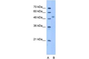Western Blotting (WB) image for anti-Zinc Finger Protein 763 (ZNF763) antibody (ABIN2463332) (ZNF763 抗体)