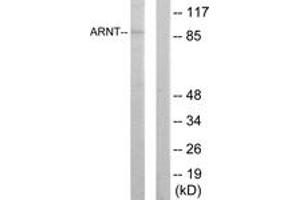 Western blot analysis of extracts from HepG2 cells, using ARNT Antibody. (ARNT 抗体  (AA 31-80))