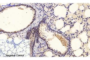 anti-Mitogen-Activated Protein Kinase 1/3 (MAPK1/3) (pTyr205), (pTyr222) antibody