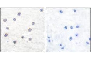 Immunohistochemistry analysis of paraffin-embedded human brain, using Tyrosine Hydroxylase (Phospho-Ser40) Antibody. (Tyrosine Hydroxylase 抗体  (pSer71))