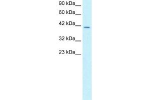 WB Suggested Anti-SMAD3 Antibody Titration:  2. (SMAD3 抗体  (N-Term))