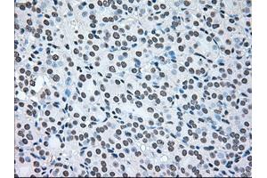 Image no. 1 for anti-B-Raf proto-oncogene, serine/threonine kinase (BRAF) antibody (ABIN1496961) (BRAF 抗体)