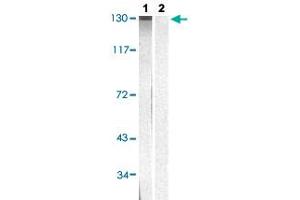 Western blot analysis of Lane 1: HepG2 cells, Lane 2: antigen-specific peptide treated HepG2 cells with EPHA2/EPHA3/EPHA4 (phospho Y588/Y596) polyclonal antibody  at 1:500-1:1000 dilution. (EPH Receptor A2 抗体  (pTyr588, pTyr596))