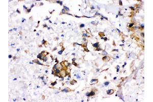 Immunohistochemistry (IHC) image for anti-Cytochrome P450, Family 1, Subfamily A, Polypeptide 2 (CYP1A2) (AA 185-320) antibody (ABIN3043820)