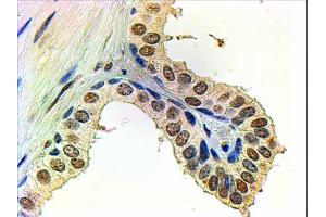 ABIN185266 (2µg/ml) staining of paraffin embedded Human Prostate. (Androgen Receptor 抗体  (N-Term))