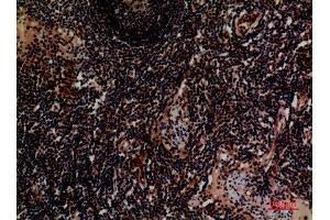 Immunohistochemistry (IHC) analysis of paraffin-embedded Human Lymph, antibody was diluted at 1:100. (ITGA4 抗体  (Internal Region))