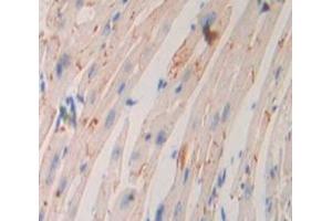 Used in DAB staining on fromalin fixed paraffin- embedded Kidney tissue (ADCY9 抗体  (AA 852-1065))