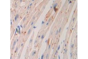 Used in DAB staining on fromalin fixed paraffin- embedded Kidney tissue (ADCY9 抗体  (AA 852-1065))