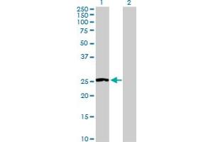 Western Blot analysis of NNMT expression in transfected 293T cell line by NNMT MaxPab polyclonal antibody. (NNMT 抗体  (AA 1-264))