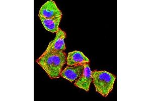 Immunofluorescence (IF) image for anti-Chemokine (C-X-C Motif) Receptor 2 (CXCR2) antibody (ABIN7193274)
