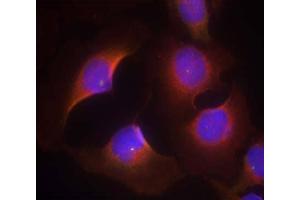 Immunofluorescence staining of methanol-fixed HeLa cells using CDK6 (phospho-Tyr13) Antibody (E011542, Red) (CDK6 抗体  (pTyr13))