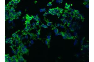 Image no. 1 for anti-Keratin 10/13 antibody (ABIN335338) (Keratin 10/13 抗体)