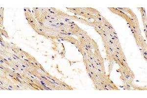 Detection of TGFb1 in Rat Cardiac Muscle Tissue using Polyclonal Antibody to Transforming Growth Factor Beta 1 (TGFb1) (TGFB1 抗体  (AA 279-390))