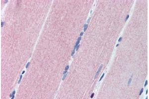 Human Skeletal Muscle (formalin-fixed, paraffin-embedded) stained with PRKG1 antibody ABIN307178 at 10 ug/ml followed by biotinylated goat anti-rabbit IgG secondary antibody ABIN481713, alkaline phosphatase-streptavidin and chromogen.