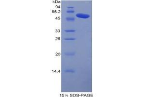 SDS-PAGE analysis of Mouse Carboxypeptidase N1 Protein. (CPN1 蛋白)
