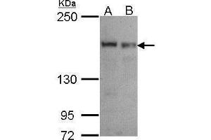 WB Image Sample (30 ug of whole cell lysate) A: A549 B: Hela 5% SDS PAGE antibody diluted at 1:1000 (SEC31A 抗体  (N-Term))