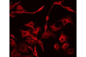 ABIN6266845 staining HepG2 by IF/ICC. (EFNA4 抗体  (Internal Region))